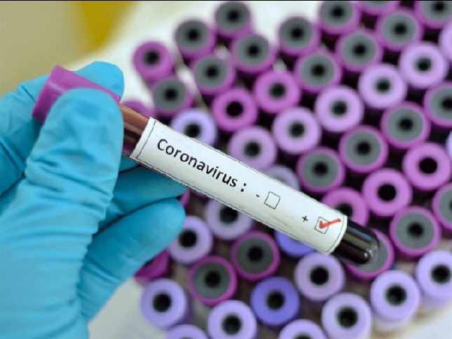 Confirmed COVID-19 Cases In Nigeria Hit 16,085 After 403 People Tested Positive In 24 Hours