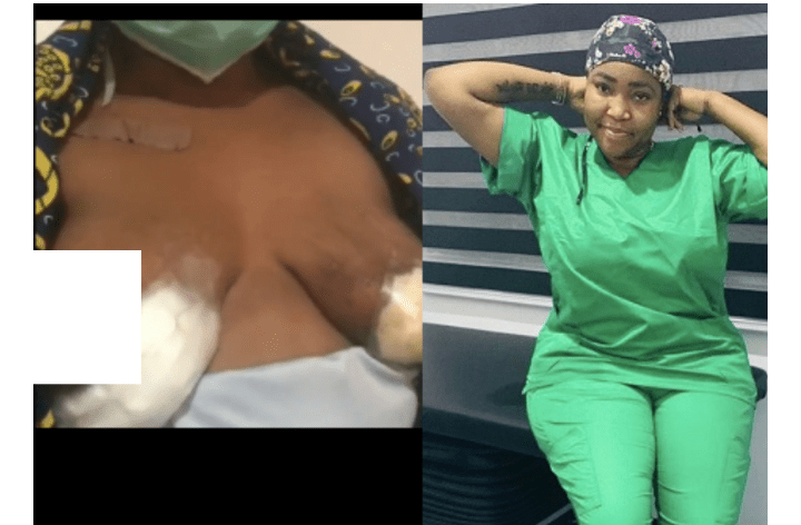 Nigerian Lady Who Has Bilateral Breast Abscess After Plastic Surgery Allegedly Performed By Dr Anu Cries Out (Photos)