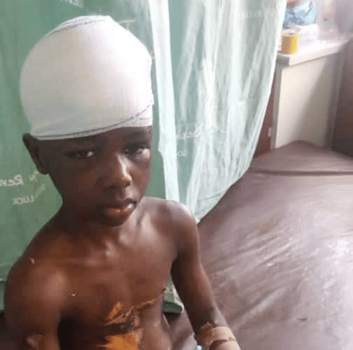 Woman Arrested For Drilling Nails And Using Hot Iron On Her 10-Year-Old Domestic Help’s Head In Enugu