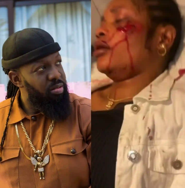 Hit and run accident: Timaya denies arrest by police, says he was only interrogated