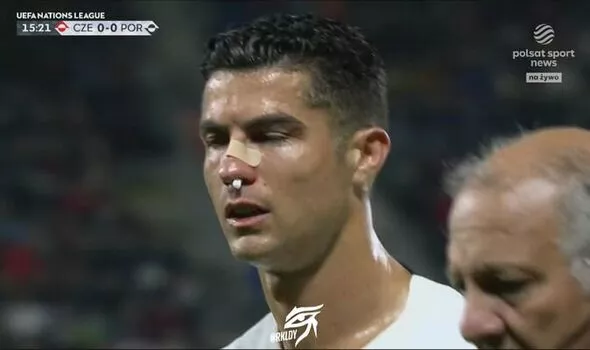 Cristiano Ronaldo left bruised and bloodied after sickening collision in Portugal match