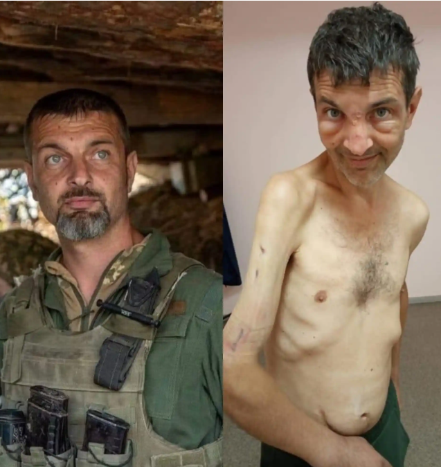 See shocking before and after photos of Ukranian soldier recently released in prisoner swap after four months in Russian captivity (photos)