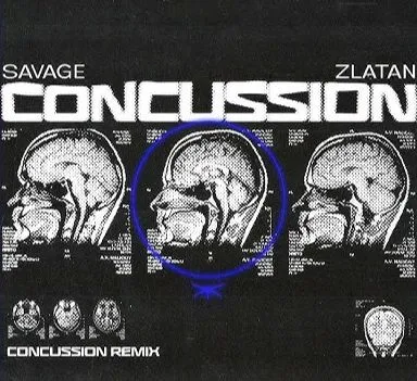 Savage & Zlatan – Concussion (Remix)